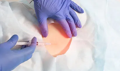 Sacroiliac Joint Injections