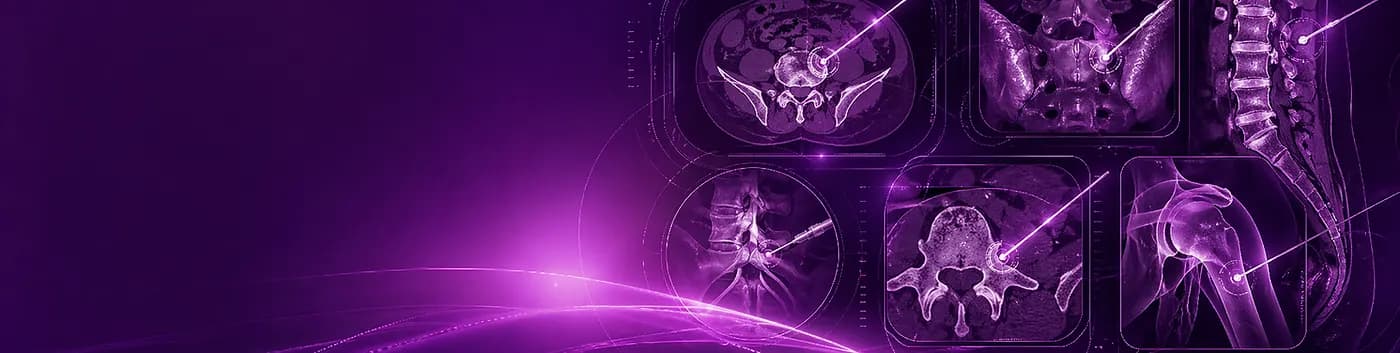 CT Guided Injections