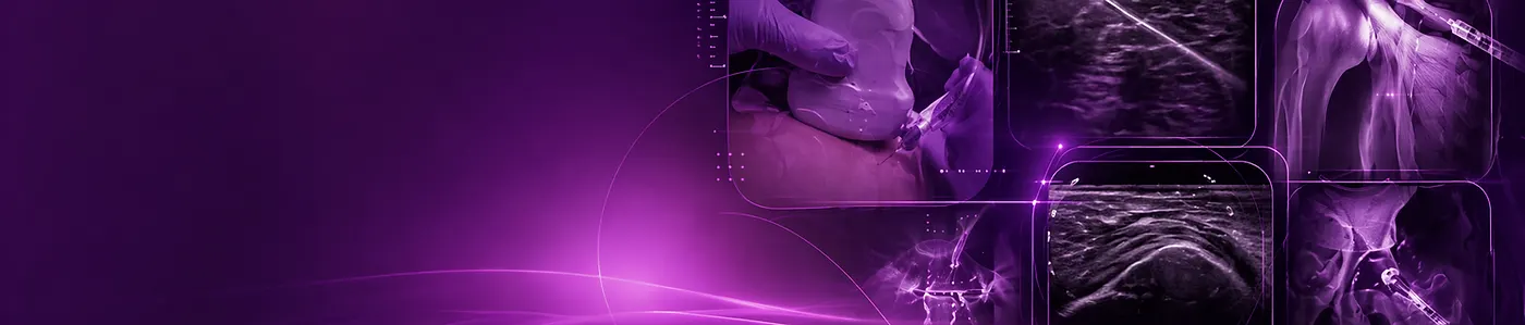 Ultrasound Guided Injections